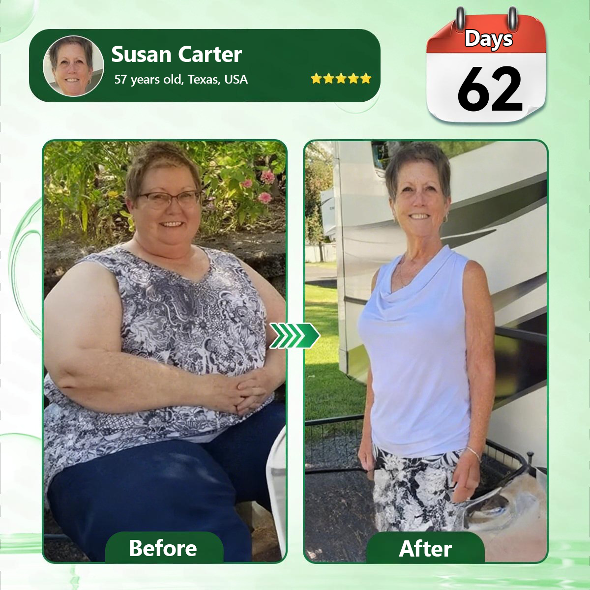 💖⏰Just Today |🇺🇸𝐂𝐚𝐫𝐞𝐔𝐩𝐥𝐢𝐟𝐭®𝑴𝒐𝒓𝒊𝒏𝒈𝗮 · 𝗕𝗲𝗿𝗯𝗲𝗿𝙞𝙣𝙚 × 𝙉𝘼𝐃+ 𝟏𝟎-𝐢𝐧-𝟏 𝗔𝗱𝘃𝗮𝗻𝗰𝙚𝙙 𝙉𝙖𝙣𝙤 𝙈𝙞𝙘𝙧𝙤𝙣𝙚𝙚𝐝𝐥𝐞 𝐏𝐚𝐭𝙘𝙝(𝐉𝐮𝐬𝐭 𝐨𝐧𝐜𝐞 𝐚 𝐝𝐚𝐲, 𝐯𝐢𝐬𝐢𝐛𝐥𝐞 𝐜𝐡𝐚𝐧𝐠𝐞𝐬 𝐢𝐧 𝟕 𝐝𝐚𝐲𝐬） ✅ 𝐅𝐨𝐫 𝐨𝐛𝐞𝐬𝐢𝐭𝐲, 🅛🅞🅞🅢🅔 🅢🅚🅘🅝,𝐝𝐢𝐚𝐛𝐞𝐭𝐞𝐬, 𝐬𝐥𝐞𝐞𝐩 𝐚𝐩𝐧𝐞𝐚, 𝐣𝐨𝐢𝐧𝐭 𝐢𝐬𝐬𝐮𝐞𝐬, 𝐚𝐧𝐝 𝐦𝐨𝐫𝐞💯💯