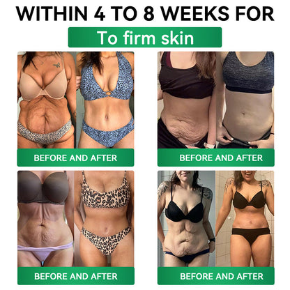 𝐂𝐚𝐫𝐞𝐔𝐩𝐥𝐢𝐟𝐭® 𝑴𝒆𝒕𝒂𝒃𝒐𝒍𝒊𝒄 𝑵𝒂𝒏𝒐 𝑴𝒊𝒄𝒓𝒐𝒏𝒆𝒆𝒅𝒍𝒆 𝑷𝒂𝒕𝒄𝒉🇺🇸(𝐉𝐮𝐬𝐭 𝐨𝐧𝐜𝐞 𝐚 𝐝𝐚𝐲, 𝐯𝐢𝐬𝐢𝐛𝐥𝐞 𝐜𝐡𝐚𝐧𝐠𝐞𝐬 𝐢𝐧 𝟕 𝐝𝐚𝐲𝐬）𝘽𝙚𝙧𝙗𝙚𝙧𝙞𝙣𝙚 + 𝙈𝙤𝙧𝙞𝙣𝙜𝙖 𝙁𝙤𝙧𝙢𝙪𝙡𝙖 ✅ 𝐅𝐨𝐫 𝐨𝐛𝐞𝐬𝐢𝐭𝐲, 𝗟𝗼𝗼𝘀𝗲 𝘀𝗸𝗶𝗻,𝐝𝐢𝐚𝐛𝐞𝐭𝐞𝐬, 𝐬𝐥𝐞𝐞𝐩 𝐚𝐩𝐧𝐞𝐚, 𝐣𝐨𝐢𝐧𝐭 𝐢𝐬𝐬𝐮𝐞𝐬, 𝐚𝐧𝐝 𝐦𝐨𝐫𝐞 💯💯